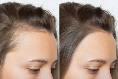 HairUp™ Crema para crecimiento del cabello